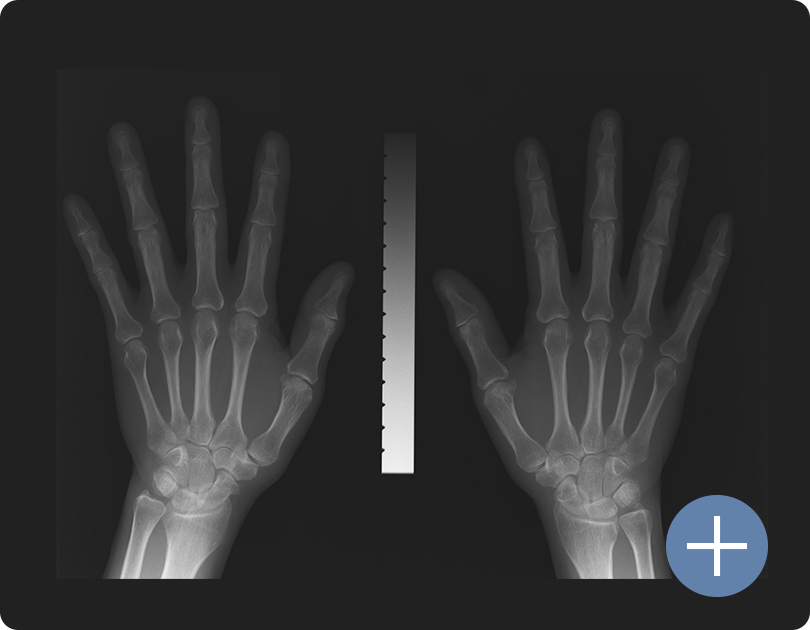 オンライン骨密度解析サービス MYOUI